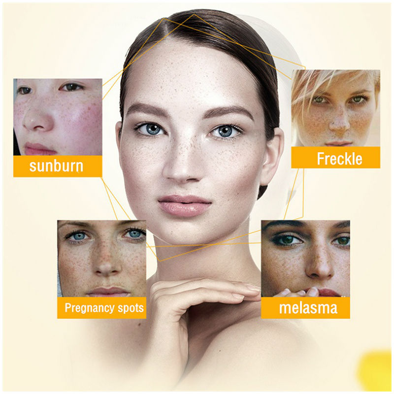 Dimollaure krem wybielający pi – Retinol Cream recenzja i cena