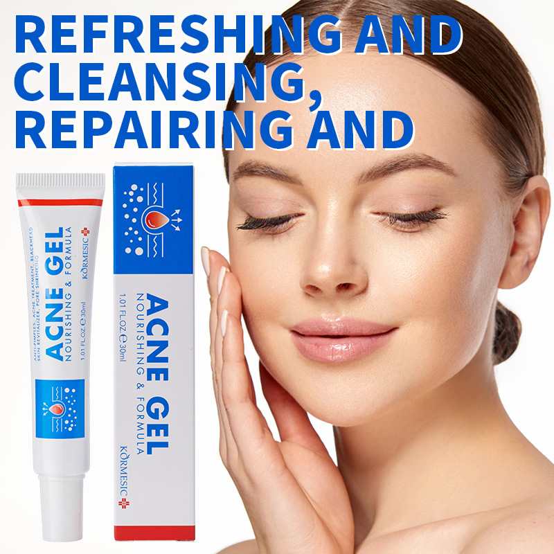 30g Żel usuwający trądzik, kre – Face Moisturizer recenzja i cena